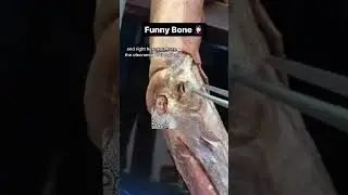 🤦🏻‍♀️Funny Bone 🦴 #drbenaduce #anotomy #funny #bones #ulnarnerve