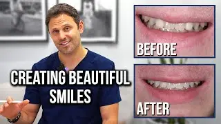 Congenitally Missing Lateral Incisors - Dental Science