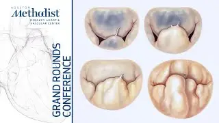 Reimagining GDMT for Chronic Heart Failure (Hsi, MD) Mitral Valve Prolapse (El-Tallawi, MD) 05/06/21