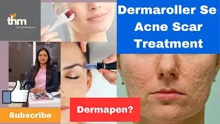 Dermaroller Ghar par kaise kare | Acne Scar Treatment | How to us Dermarolller and Dermapen At Home