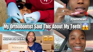 😱 THIS HAPPENED AT MY APPOINTMENT WITH MY ORTHODONTIST 🥹 | FINALLY GOT POWERCHAINS | P.O BOX OPENING