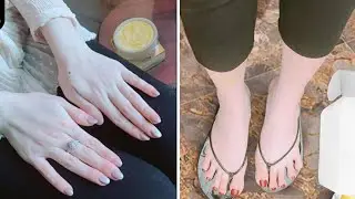 most effective Sun tan removal home remedies | get fair hand & feet in 1 day naturally..