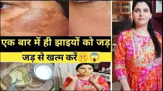 झाइयां|Pigmentation face pack |Mother Sparsh|Pigmentation Face Pack |Pigmentation Night cream