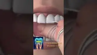 #doctor #teethwhitening #beauty #dentalcare #smile #dentaldoctor #dentition #dentist #nurse