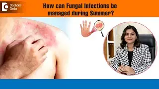 Summer #skin Issues | Fungal Infection Prevention, and Treatment | Underarm Sweating- Dr.Nydile S V