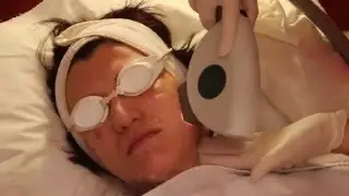 IPL Skin Rejuvenation Timelapse at Tracey Bell Dental and Aesthetic Medical Clinic