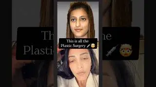 This is all the PLASTIC SURGERY 💉Shruti Hassan has had!#trending #plasticsurgery #shrutihaasan