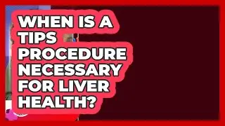 When Is A TIPS Procedure Necessary For Liver Health? - Liver Health Hub