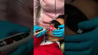 Explorando as Vantagens do Laser Infravermelho na Odontologia Avan&ccedil;ada