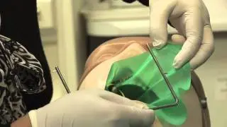 MR.Dental's How to Guide: How to Prepare and Apply a Rubber Dam