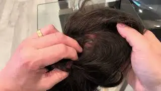 UNBOXING HAIR SYSTEM | LAVIVID HELIOS