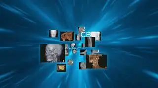 NewTom 7G CBCT