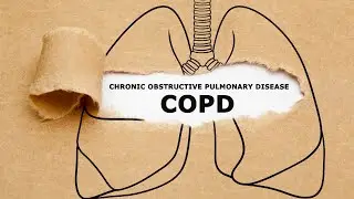 Understanding COPD: A Progressive Lung Disease | Dr. Shivanshu Raj Goyal