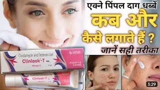 Clinlook t tel | clinlook gel | pimple best gel | पिंपल की दवाई | खिल मुंहासों के लिए अच्छी क्रीम