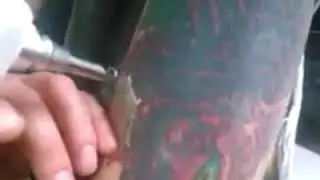 Laser Tattoo Removal - colored tattoo