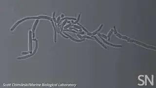 Watch bacteria found on our teeth rapidly divide and grow | Science News
