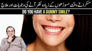 Gummy Smile Causes & Treatment | مسوڑھوں کا زیادہ نظر آنا | Dr Imran Zia | Dental Guild