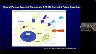 Advances in the Diagnosis and Treatment of BPDCN &ndash; Dr. Naveen Pemmaraju (May 26-27, 2023)