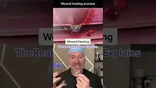 How Wound Healing Actually Works ❤️&zwj;🩹 #shorts