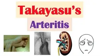 Session 10/05, LCC; 1- Young female e&rsquo; severe headache, 2- Young female e&rsquo; Weight loss and fatigue