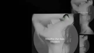 Veluderm lift and liporeduction