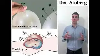 Mrs Donald's balloon and fetal surgery | Hudson Institute
