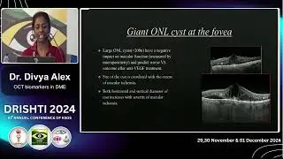 KSOS 2024 IC21 T Dr Divya Alex  OCT biomarkers in DME