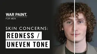 TACKLING COMMON SKIN CONCERNS | REDNESS & UNEVEN TONE