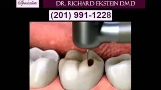 Smile Design Specialists Learn About Inlays & Onlays