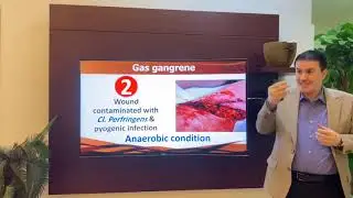 19 (3-6) Cl. perfringens Gas gangrene