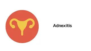 Entz&uuml;ndungen von Eierst&ouml;cken und Eileiter (Adnexitis) - Erkrankungen der Geschlechtsorgane
