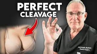 What Is a Perfect Breast Implant Cleavage