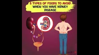 5 Healthy Heart Tips by Cardiac Specialists