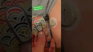 Lillian&rsquo;s First Dexcom G7 #diabetes #dexcom #t1d #cgm #dexcomg7 #type1diabetes