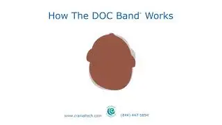 How The DOC Band&reg; Works