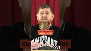 Любимый сын Кадырова почти ослеп. И изменился до неузнаваемости