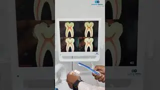 Supreme Dental Intra Oral Camera