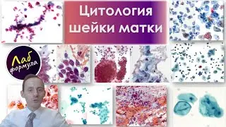 Цитология шейки матки по книге W Khalbuss.  Часть I. Трейлер.