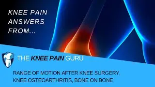 Range of Motion AFTER Knee Surgery, Osteoarthritis, Bone on Bone by The Knee Pain Guru #KneeClub