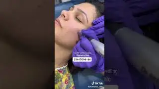 Face prp treatment by Dr Ahsan Riaz at Plasthetics clinic Johar Town Lahore
