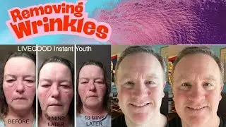 Removing wrinkles lines and bags under eyes with LiveGood Instant Youth