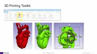 Simpleware Software for Point-of-Care 3D Printing | Medical Imaging to 3D Models