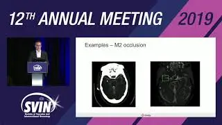 SVIN 2019: VizAI: Role in LVO Detection and Stroke Performance Metrics (Non-CME)