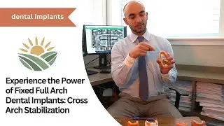 Experience the Power of Fixed Full Arch Dental Implants: Cross Arch Stabilization