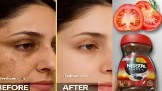 Japanese Secret Whitening Cream that Removes dark skin pigmentation wrinkles dark spots