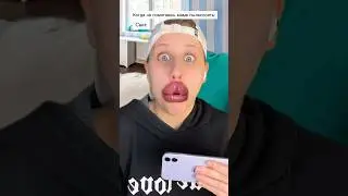 Что с губами? 😂 #shorts