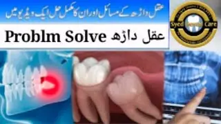 Wisdom Tooth Pain Relief Home Tips | Wisdom Tooth Pain and Advice Wisdom Wisdom Tooth Pain