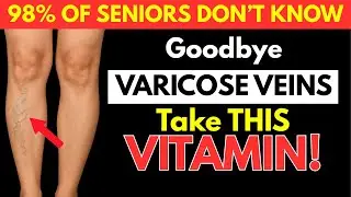 Seniors! &ldquo;Over 60?: This VITAMIN DISSOLVE BLOOD CLOTS in Your LEGS!&rdquo;