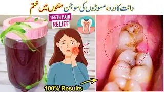 Fast Relief for Teeth Pain | Natural Mouthwash | Home Remedy for Toothache & Gum Swelling