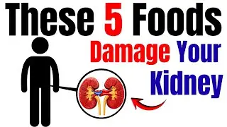 5 Foods That Can Quietly Damage Your Kidneys (Most People Eat Them Daily)